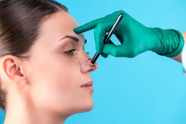 Rhinoplasty