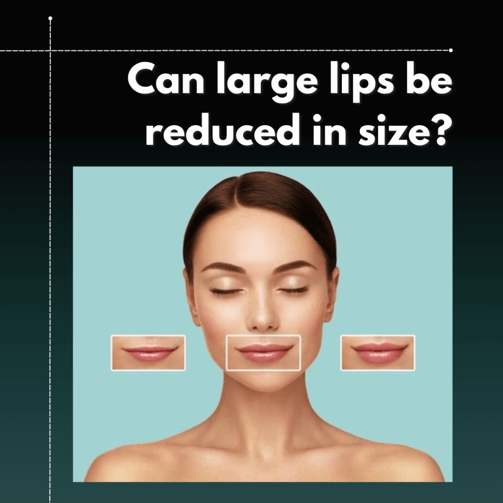 Ear Lobe Repair Surgery ear-lobe-repair-surgery