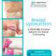 Breast liposuction