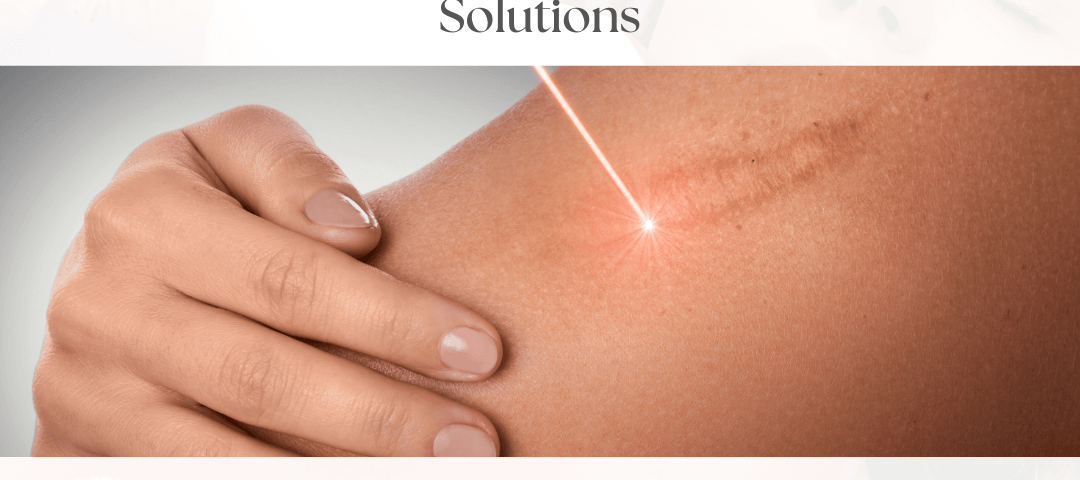 Scar removal