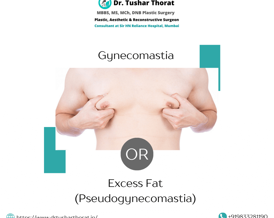 gynecomastia surgery in mumbai
