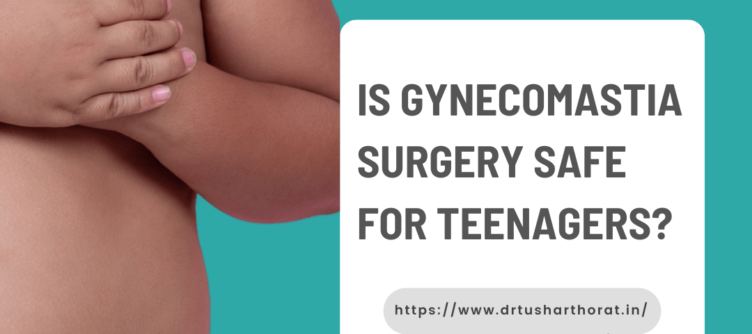 teenager gynecomastia