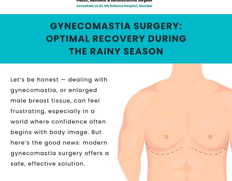 Gynecomastia recovery in monsoon