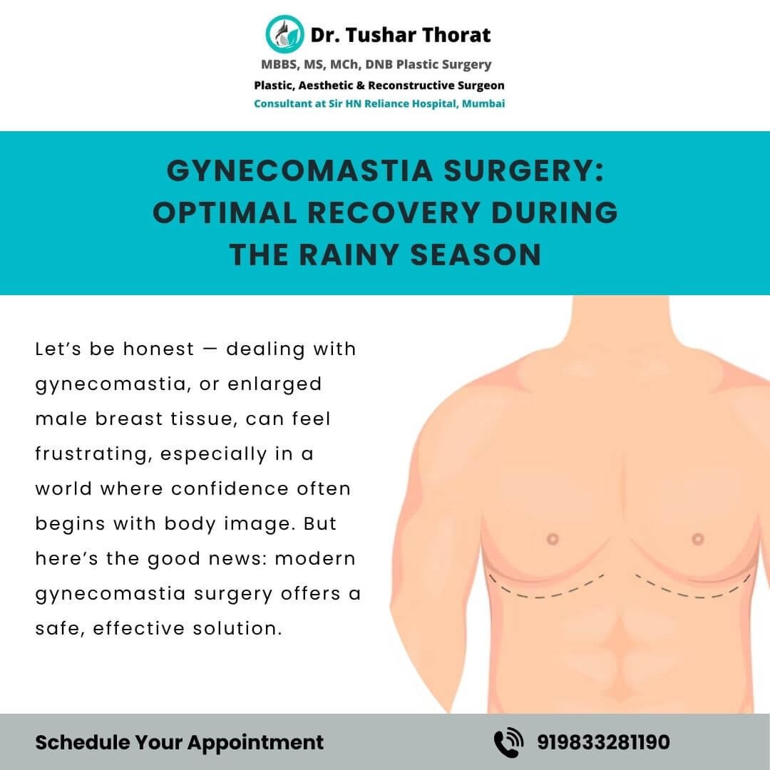 Gynecomastia recovery in monsoon