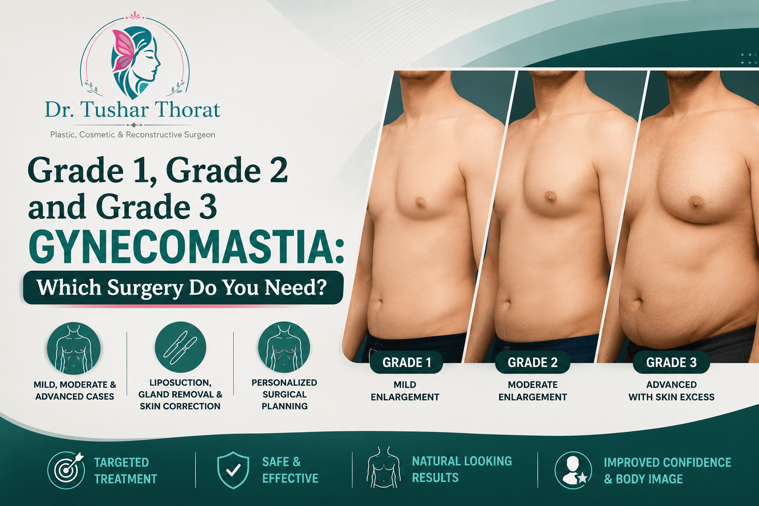 Gynecomastia surgery in mumbai